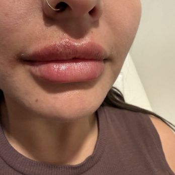 Perla MD - Medical Spas Near Me - Tijuana, BCN