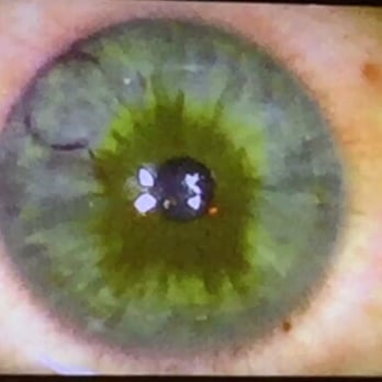 Aloha Laser Vision - Mid LASIK - Ophthalmologists Near Me - Honolulu, Hawaii Aloha Laser Vision - Mid LASIK - Ophthalmologists Near Me - Honolulu, Hawaii