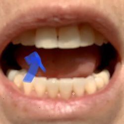 Pacific Endodontics - After Dr Lin