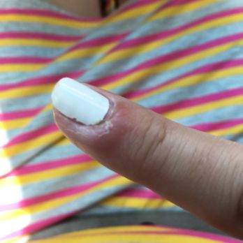 Expo Nails - Puss was around most of the nail and I drained it to get the swelling to go down which is why there's cracked skin there's still infection - Nail Salons Near Me - Miami, Florida Expo Nails - Puss was around most of the nail and I drained it to get the swelling to go down which is why there's cracked skin there's still infection - Nail Salons Near Me - Miami, Florida