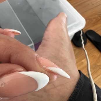 Green Nail - Improperly installed Gel X. Bad French. - Nail Salons Near Me - Sherman Oaks, California Green Nail - Improperly installed Gel X. Bad French. - Nail Salons Near Me - Sherman Oaks, California