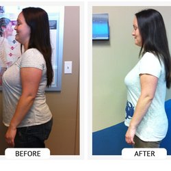 Oceanside Wellness Center - Typical results with the Chirothin Weight loss program!