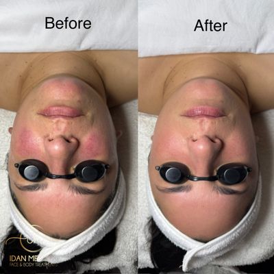 Idan Med Spa by null