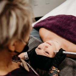 True Nature Skin+Energy MedSpa - We offer microneedling with Hyaluronic Acid and PRP
