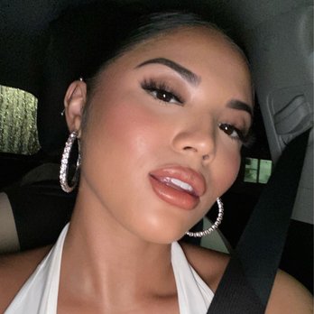 Locococo Aesthetix - first day of lip filler, so in love with my pout now! - Medical Spas Near Me - Aiea, Hawaii