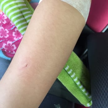 Quest Diagnostics - Ana Marie puncture my daughters arm with her nails using so much force. - Laboratory Testing Near Me - Alhambra, California
