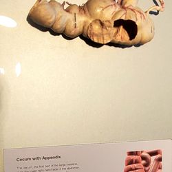 Body Worlds Exhibit