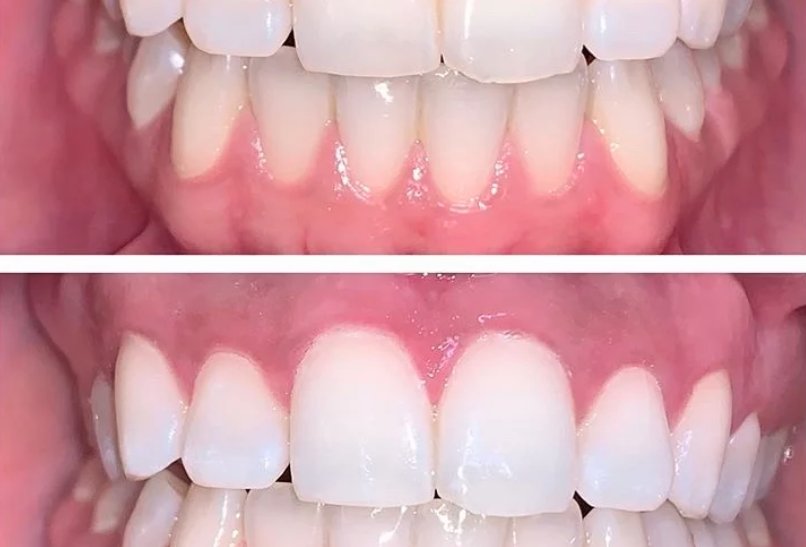 EXQUISITE SMILES TEETH WHITENING Request an Appointment Charlotte