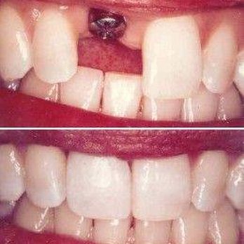 Village Dental - Orthodontists Near Me - Kenilworth, Illinois Village Dental - Orthodontists Near Me - Kenilworth, Illinois