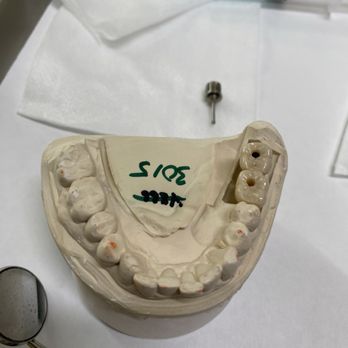 Clear Choice Riverside - Two implants - Cosmetic Dentists Near Me - Riverside, California Clear Choice Riverside - Two implants - Cosmetic Dentists Near Me - Riverside, California