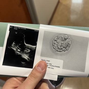 Nevada Fertility Center - Our embryo :) - Fertility Near Me - Las Vegas, Nevada Nevada Fertility Center - Our embryo :) - Fertility Near Me - Las Vegas, Nevada