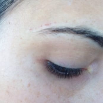 My Perfect Brows - Scabs above my eyebrow - Eyelash Service Near Me - Long Beach, California My Perfect Brows - Scabs above my eyebrow - Eyelash Service Near Me - Long Beach, California