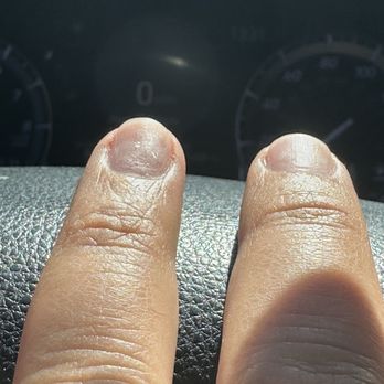 Mio Nail Spa - Over grinding around the cuticles - Nail Salons Near Me - Apple Valley, California