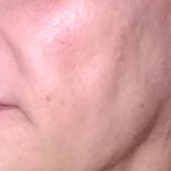 Carp Cosmetic Surgery Center - Cosmetic Surgeons Near Me - Uniontown, Ohio