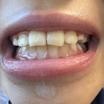 Inspire Orthodontics - Teeth - Orthodontists Near Me - Littleton, Colorado Inspire Orthodontics - Teeth - Orthodontists Near Me - Littleton, Colorado