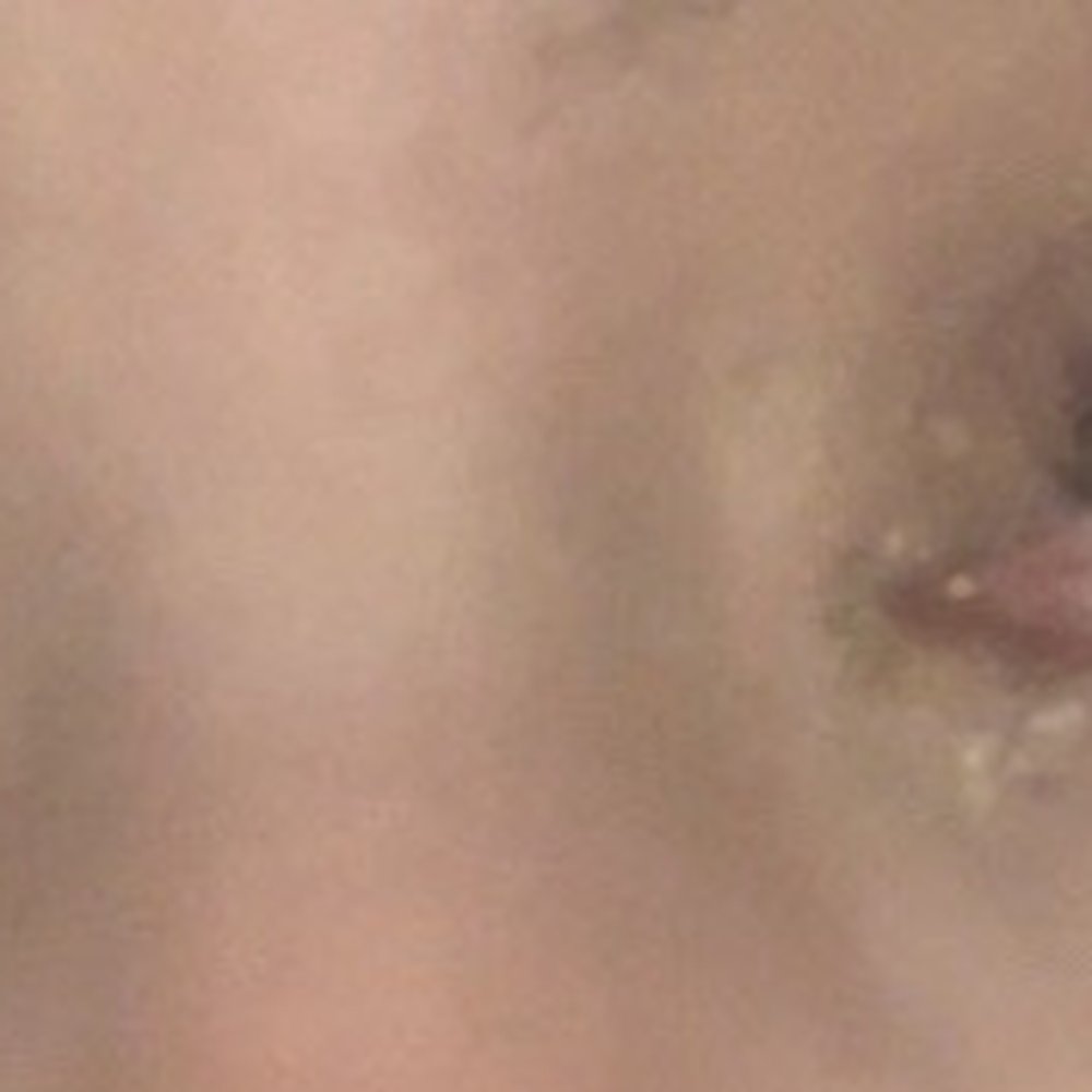 First night eyes bloodshot and crusted. First night eyes bloodshot and crusted.