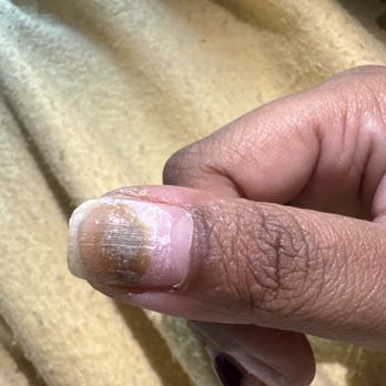 Debon Nails & Spa - what seems to be trauma or infection. - Nail Salons Near Me - Phoenix, Arizona