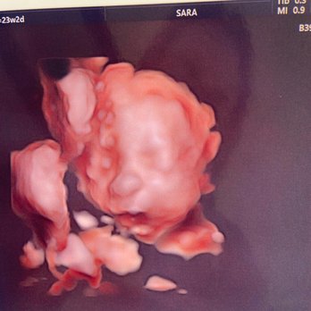 Unique Ultrasound - 23w picturw - Diagnostic Imaging Near Me - Temecula, California Unique Ultrasound - 23w picturw - Diagnostic Imaging Near Me - Temecula, California