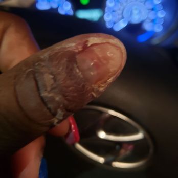 Elegant Nails And Spa - My REAL NAIL came off! - Nail Salons Near Me - Killeen, Texas