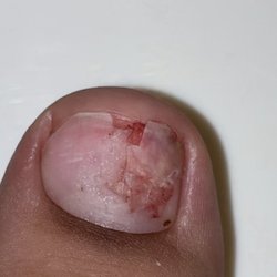 My toe