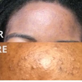 Lilli Skin Care Studio - Skin Care Near Me - Old Town Alexandria, Virginia