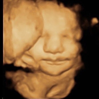 The Ultrasound Experience - Ultrasound Imaging Centers Near Me - San Marcos, California The Ultrasound Experience - Ultrasound Imaging Centers Near Me - San Marcos, California