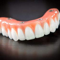 Dream Dental Implant Center - All-on-4 Dental Implants Salt Lake City Utah