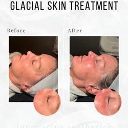 Innovative Aesthetics Medical Spa and Laser Center