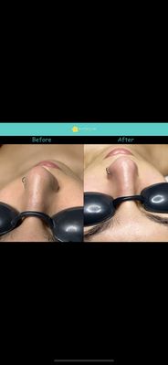 Buttercup Skin Care by null