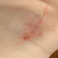 Panda Market - My bruised ribs from slipping on the WET FLOOR. The child on duty had no idea what to do.