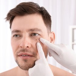 R3 Wound Care & Hyperbarics - wound care healing after MOHs surgery