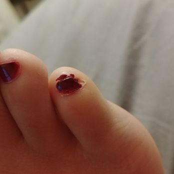 Cassandra's Esthetics Salon & Spa - Clipped pinky toe and messy polish - Skin Care Near Me - Placerville, California