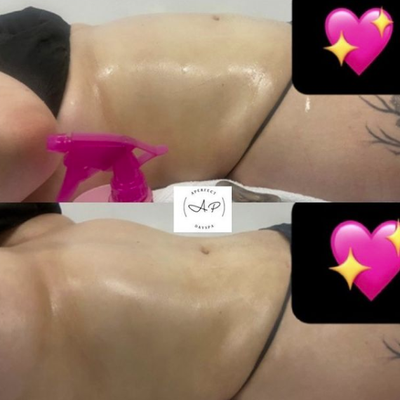 Body Sculpting - Specializing in Lymphatic Drainage Massages