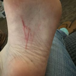 Yah’s Nail Bar - Possibly infected arch.