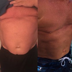 B Fit Cryo - Killing fat! Just after 4 fat burning and 1 slimming!