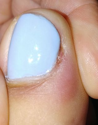 ABC NAILS - 31 Photos & 13 Reviews - Nail Salons - 15571 N Litchfield