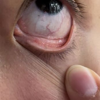 K-Lash - Eyelash extensions - Eyelash Service Near Me - Los Angeles, California