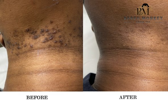 Bared Monkey Laser Spa by null