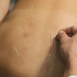 Urteaga Acupuncture & Wellness Center