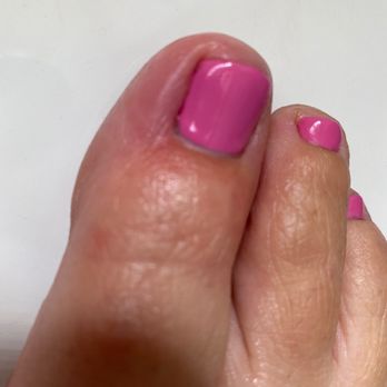 Bella Nail Bar - Infected Toe - Waxing Near Me - Everett, Washington