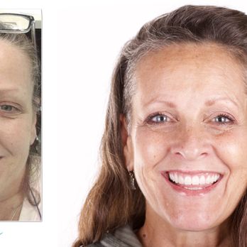 Primavera Dental Group - Dental implants - General Dentistry Near Me - Pflugerville, Texas Primavera Dental Group - Dental implants - General Dentistry Near Me - Pflugerville, Texas