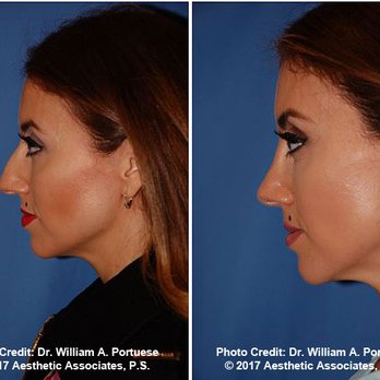 William  Portuese, MD - Plastic Surgeons Near Me - Seattle, Washington