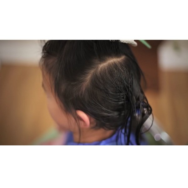 LICE REMOVAL LOS ANGELES CARE Los Angeles, California Lice Services