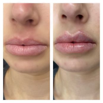 Mansfield Aesthetics - Medical Spas Near Me - Mansfield, Texas Mansfield Aesthetics - Medical Spas Near Me - Mansfield, Texas