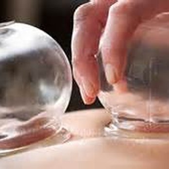 Healing Circle Community Acupuncture - Acupuncture Near Me - Chino, California