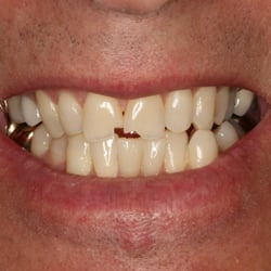 Patient Before
