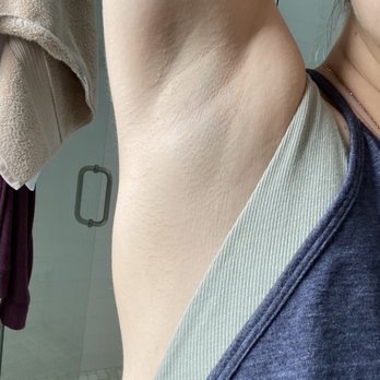 Erase Spa - Laser Hair Removal Near Me - New York, New York