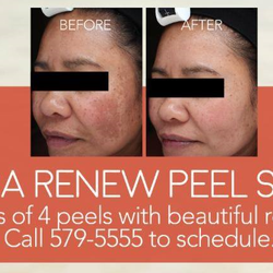clara - Actual client. Photos taken 1 year apart.