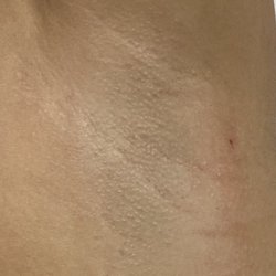 The Fuzzy Peach - Who loves a nice freshly waxed underarm!