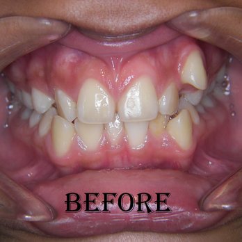 NA Dental - General Dentistry Near Me - Anaheim, California NA Dental - General Dentistry Near Me - Anaheim, California